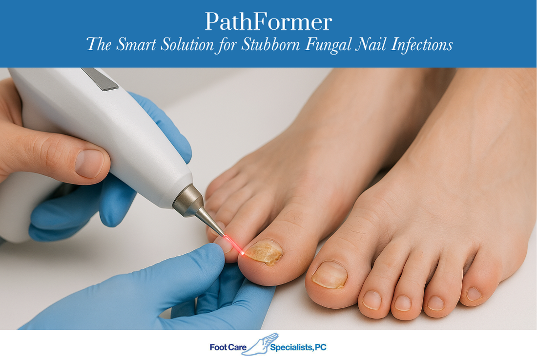 PathFormer – The Smart Solution for Stubborn Fungal Nail Infections